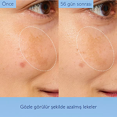 Caudalie Vinoperfect Concentrated Brightening Essence 100 ml Leke Karşıtı Aydınlatıcı Esans - 4
